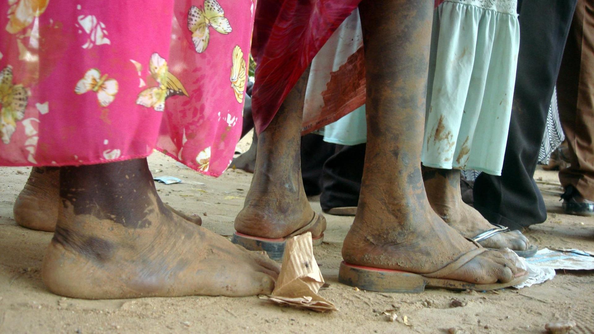 Flüchtlinge warten am 14.07.2016 am Flüchtlingslager. Zu sehen sind nackte, schmutzige Füße.