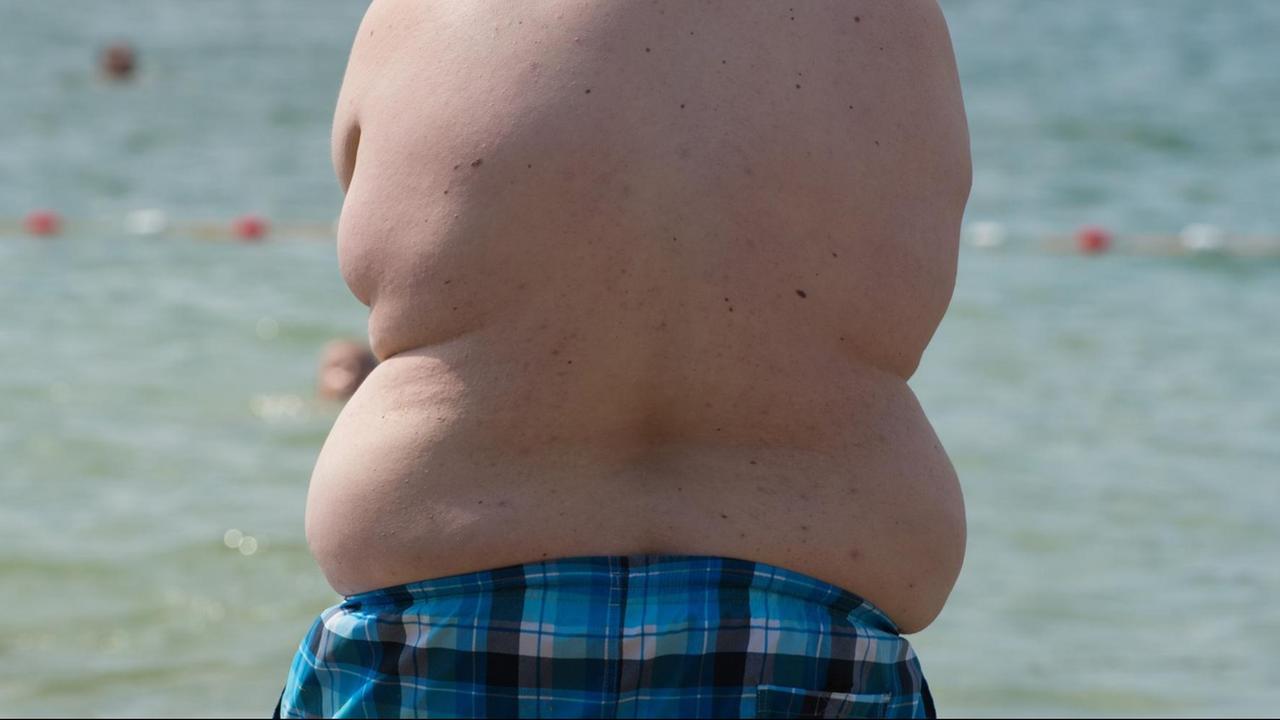 Gesundheit - Studie: Eine Milliarde Menschen von Fettleibigkeit betroffen