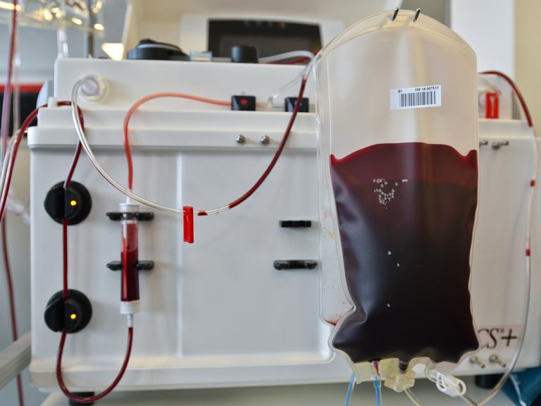 Ein Beutel mit gespendetem Blut beim Blutspendedienst.