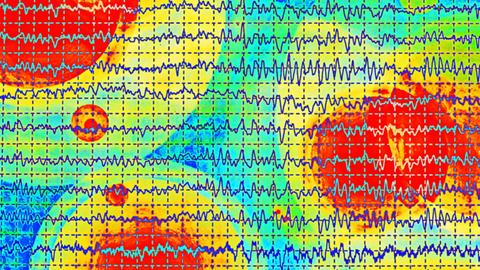 Darstellung von mehreren übereinanderliegenden Gehirnwellen im Elektroenzephalogramm (EEG), vor einem bunten Hintergrund.