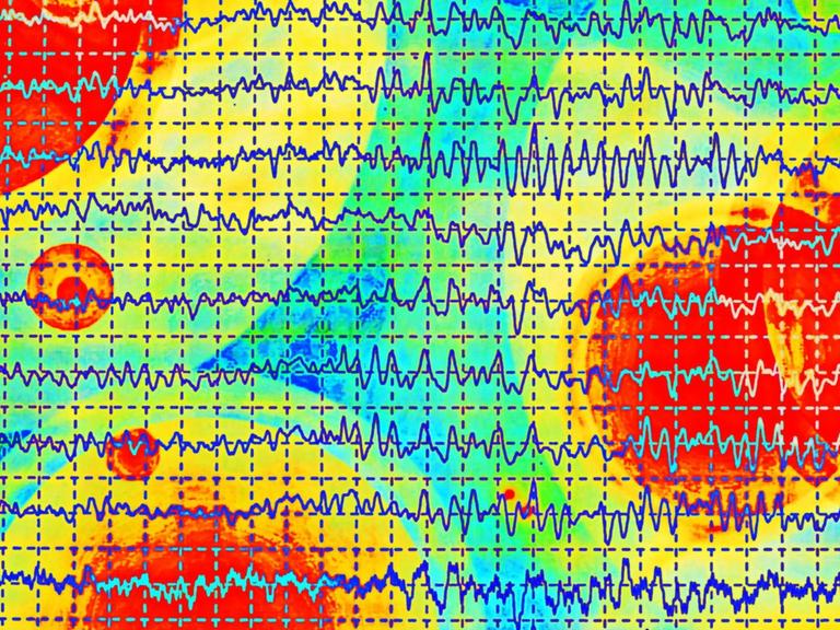 Darstellung von mehreren übereinanderliegenden Gehirnwellen im Elektroenzephalogramm (EEG), vor einem bunten Hintergrund.
