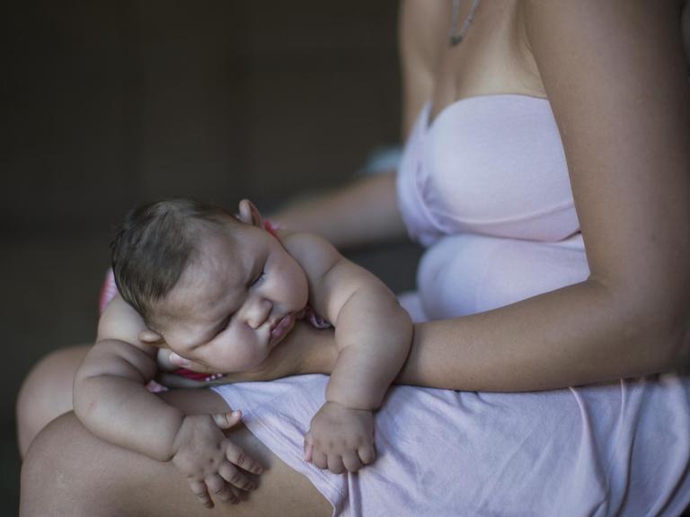 Eine Frau in Recife in Brasilien hält ihr Baby, das durch Mikrozephalie eine Schädelfehlbildung aufweist.