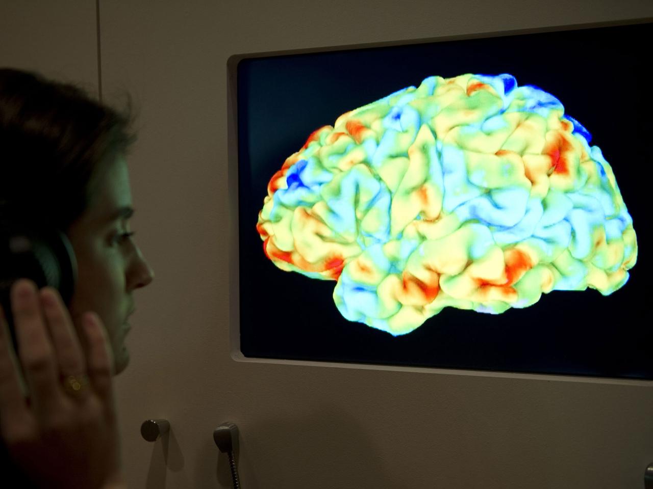 Eine Frau betrachtet eine Magnetresonanztomographie-Aufnahme (MRT) eines menschlichen Gehirns.