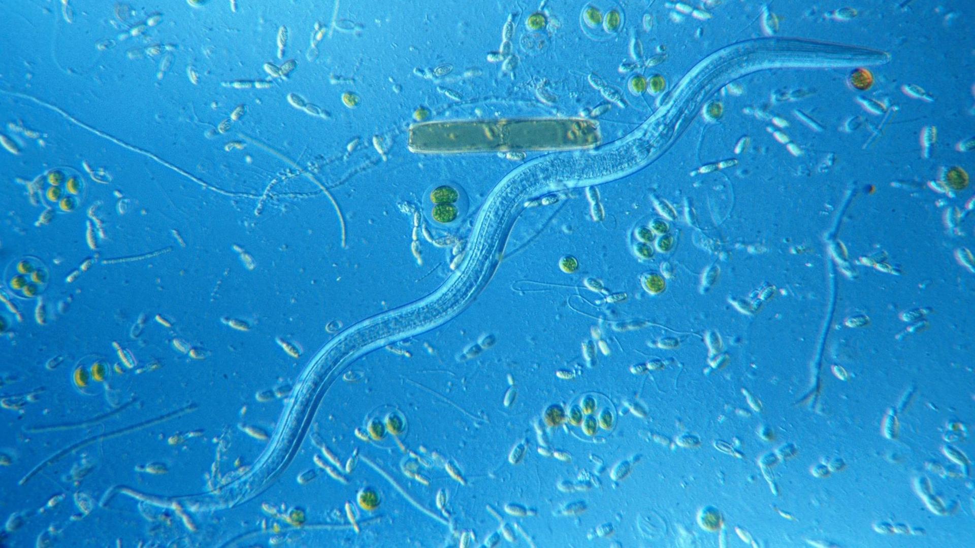 Fadenwürmer unter dem Mikroskop