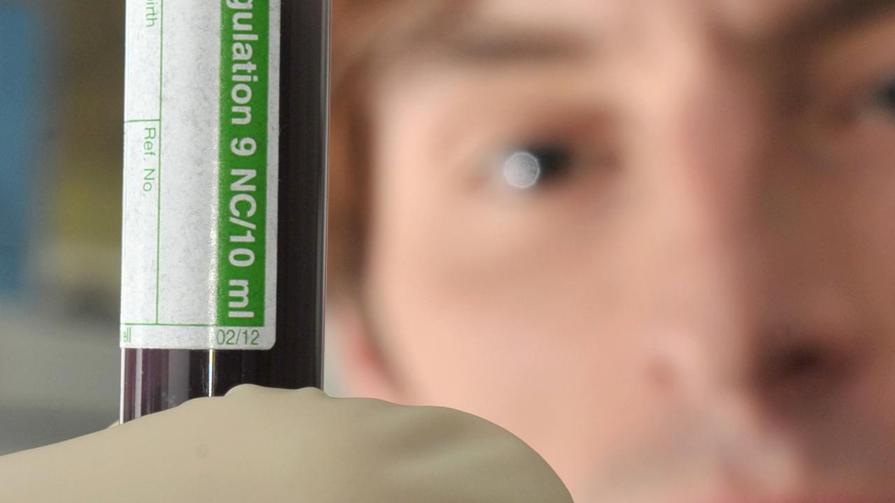 In einem Labor des medizinischen Forschungszentrums am Universitätsklinikum Jena betrachtet ein Mitarbeiter eine Blutprobe, die für einen Gerinnungstest vorbereitet wird.