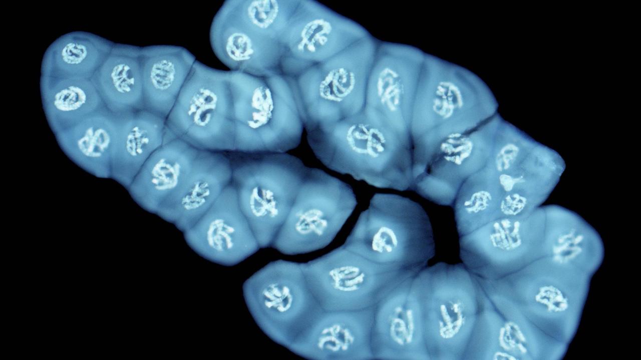 Eine Lichtmikroskopische Aufnahme eines sogenannte Riesenchromosomen einer Fluchtfliege.