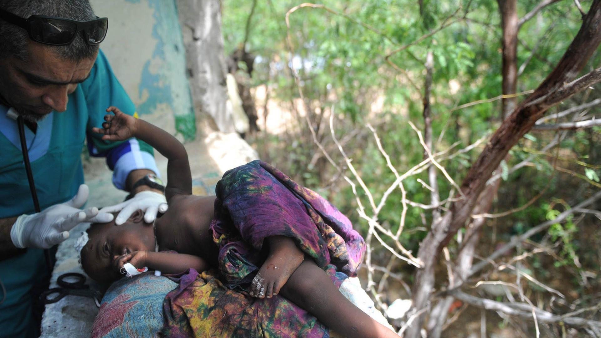 Ein südafrikanischer Arzt versorgt ein unterernährtes Kind in Somalia.
