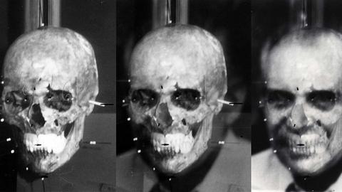 Die Installation "Mengele's skull" (2012) von Thomas Keenan und Eyal Weizman hängt in der Ausstellung "Evidentiary Realism" (2.12.2017 - 17.2.2018) in der Berliner Galerie NOME.