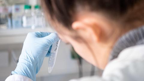 Eine Frau pipettiert in einem Labor.