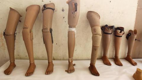 Mehrere Beinprothesen wurden an eine Wand gelehnt