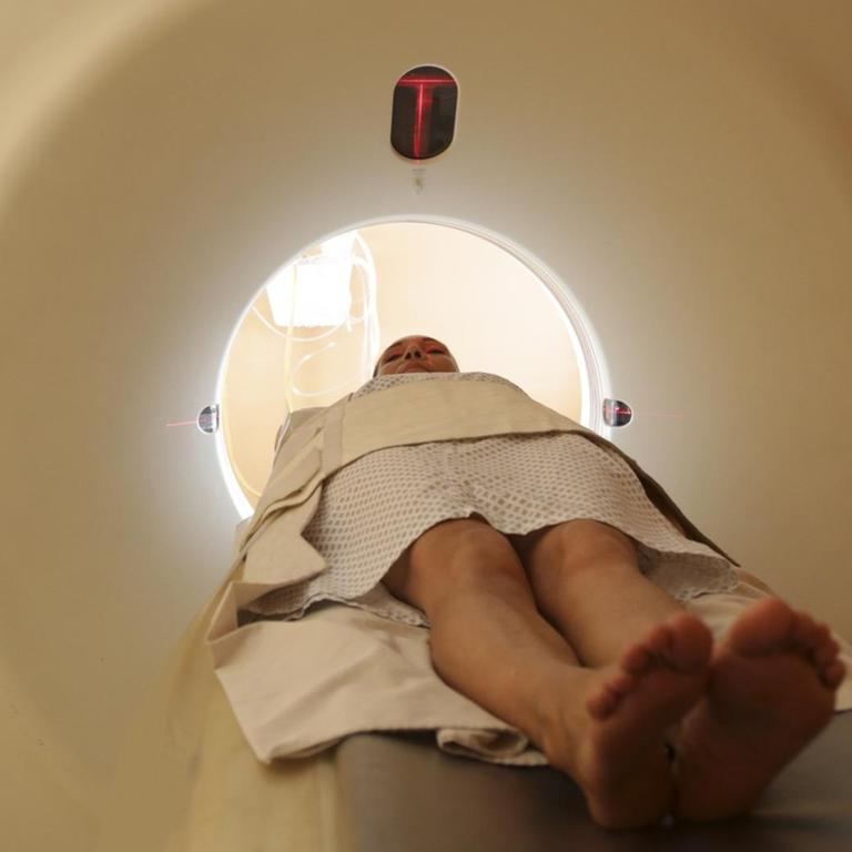 Studie: Krebsdiagnosen bei unter 50-Jährigen nehmen zu