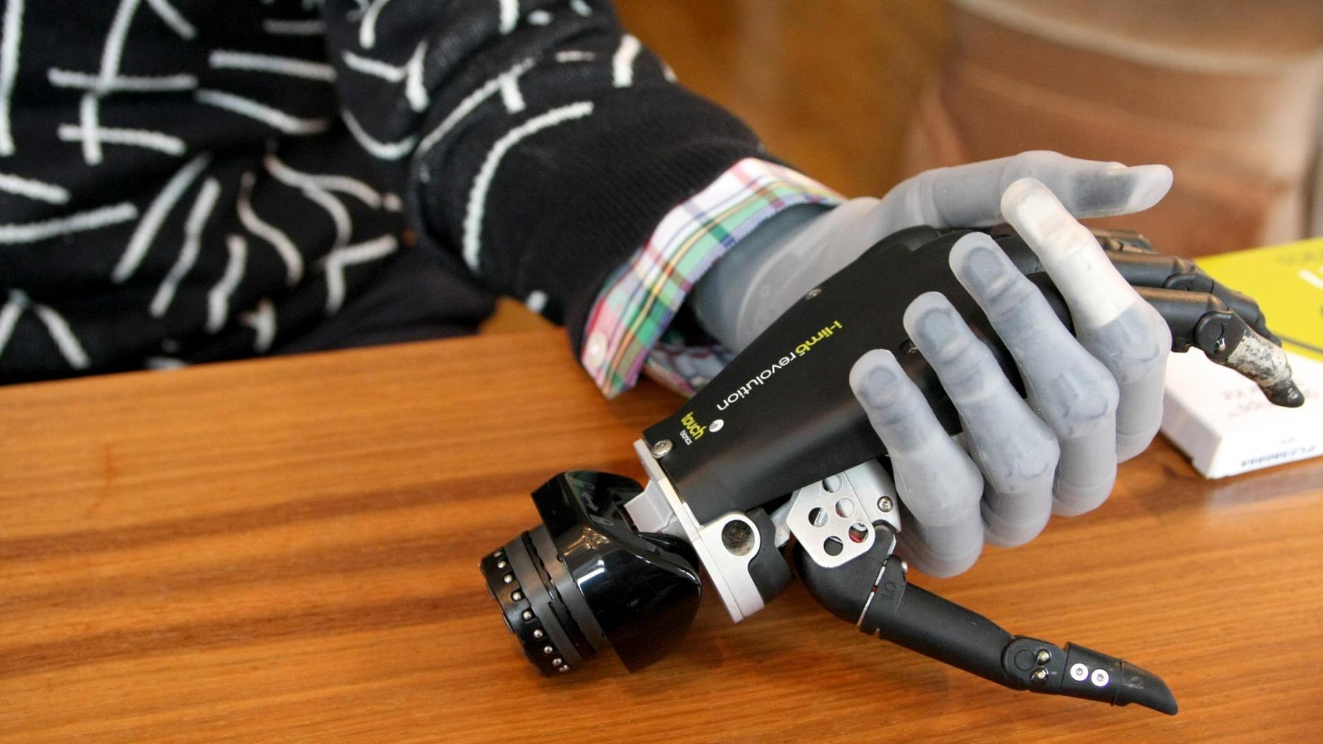 Das Foto zeigt einen Arm mit einer bionischen Handprothese, die ein weiteres Modell in der Hand hält