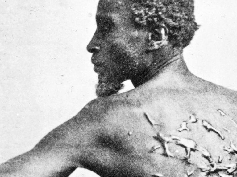 Ein Schwarzer Mann zeigt seinen von Peitschenhieben vernarbten Rücken.