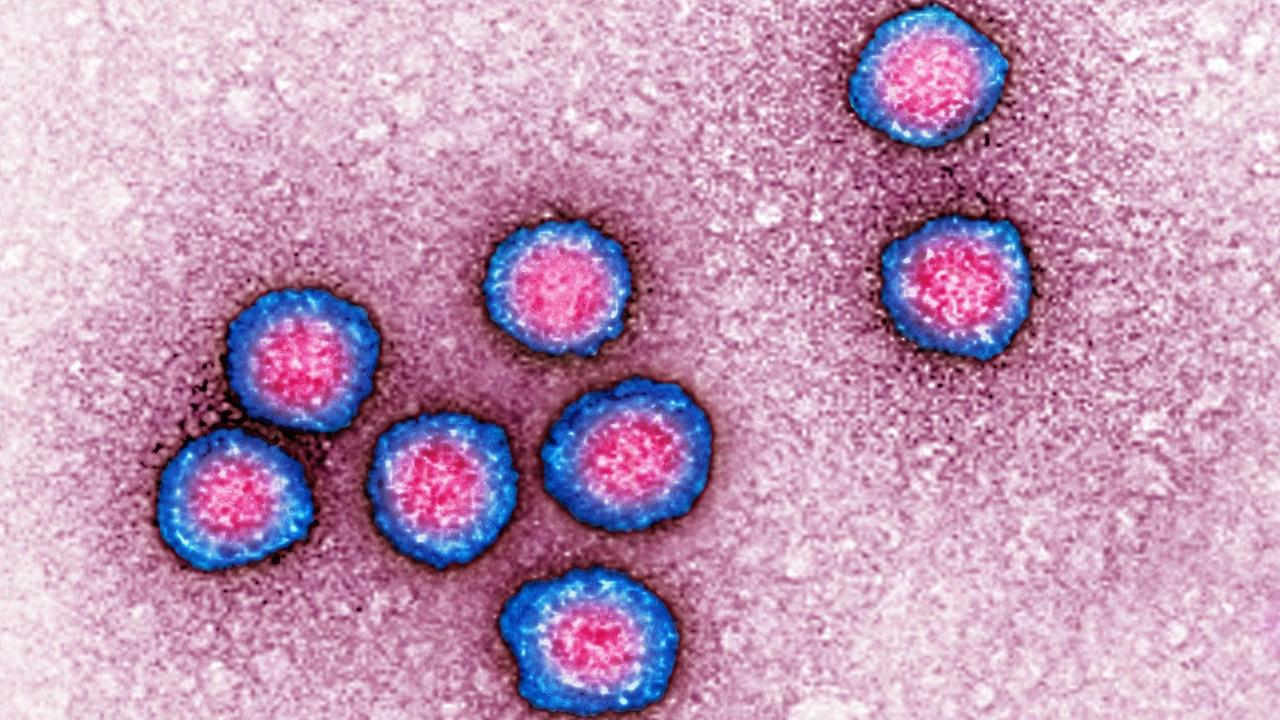 Visualisierung eines Flavivirus mit einem Transmissionselektronenmikroskop
