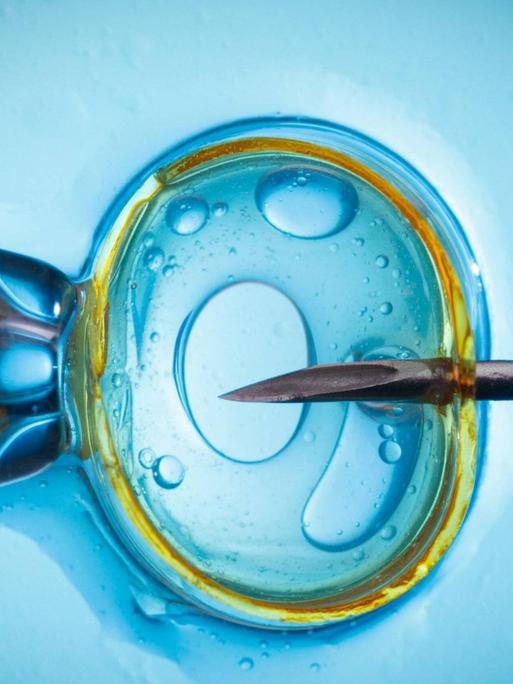 Spermieninjektion als Methode der künstlichen Befruchtung. In Tschechien ist fast alles erlaubt, was medizinisch möglich ist.