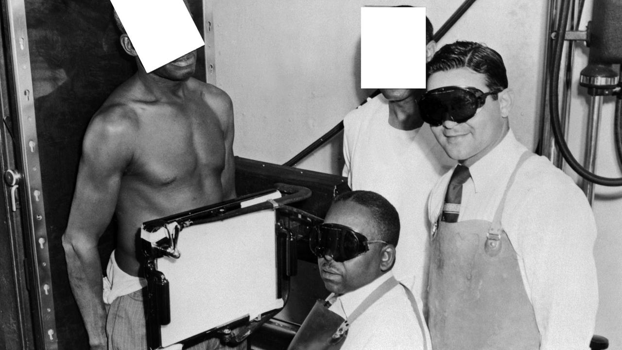 Tuskegee Syphilis Study participant being X-rayed, circa 1932. The Tuskegee Syphilis Study was carried out in Macon County, Alabama, USA, from 1932 to 1972 by the United States Public Health Service. Its objective was to study the natural course of untreated syphilis. The study recruited 600 poor African-Americans, 399 of whom had syphilis. Participants were not told their diagnosis and were only treated with placebos, even after penicillin was found to be an effective treatment for the disease. Of the original participants, 28 died as a result of syphilis and a further 100 of complications of the disease, 40 wives were infected and 19 children born with congenital syphilis. Condemnation of the study lead to congressional acts and laws that regulated human clinical trials, ensured informed consent and protected participants.