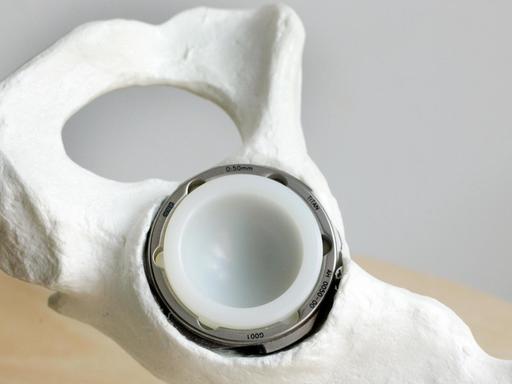 Ein Teil einer Hüftprothese, der durch ein scharfes Gewinde direkt in den Knochen geschraubt werden kann, ist am 19.06.2007 bei der aap Implantate AG in Berlin so zu sehen, dass die Verankerung in der Hüfte deutlich wird.