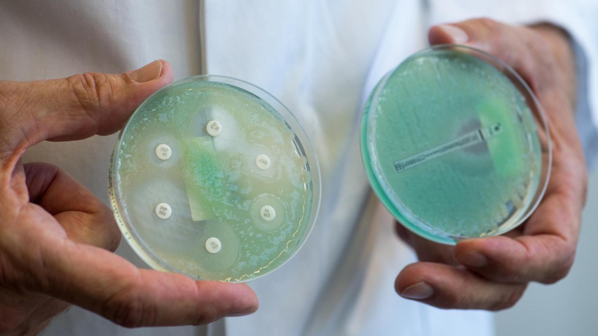 Petrischalen mit Antibiotikatestplatten mit Pseudomonas aeruginosa (grünes schleimiges Wachstum), aufgenommen am 10.04.2017 im Universitätsklinikum Regensburg (Bayern). Wulf Schneider ist Bayerns erster Professor für Krankenhaushygiene. Am Klinikum der Universität Regensburg bildet er Ärzte und medizinisches Fachpersonal weiter, berät Kliniken in Ostbayern und erforscht multiresistente Keime.