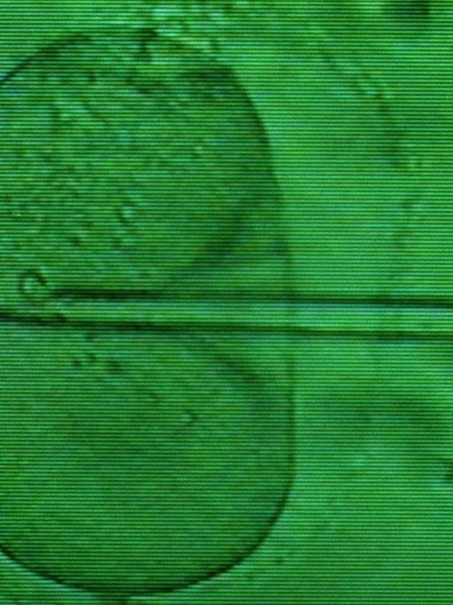 Das Monitorfoto zeigt das Einbringen einer Samenzelle in eine Eizelle mittels Mikropipette unter dem Mikroskop.