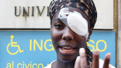 Die italienische Diskuswerferin Daisy Osakue spricht mit Journalistin vor einem Krankenhaus in Turin. Sie wurde mit Eiern beworfen und am Auge verletzt. Es handelt sich um einen mutmaßlich rassistischen Anschlag.