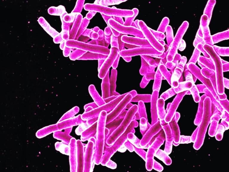 Mikroskopische Aufnahme eines rosa fadenartigen Mykobakteriums