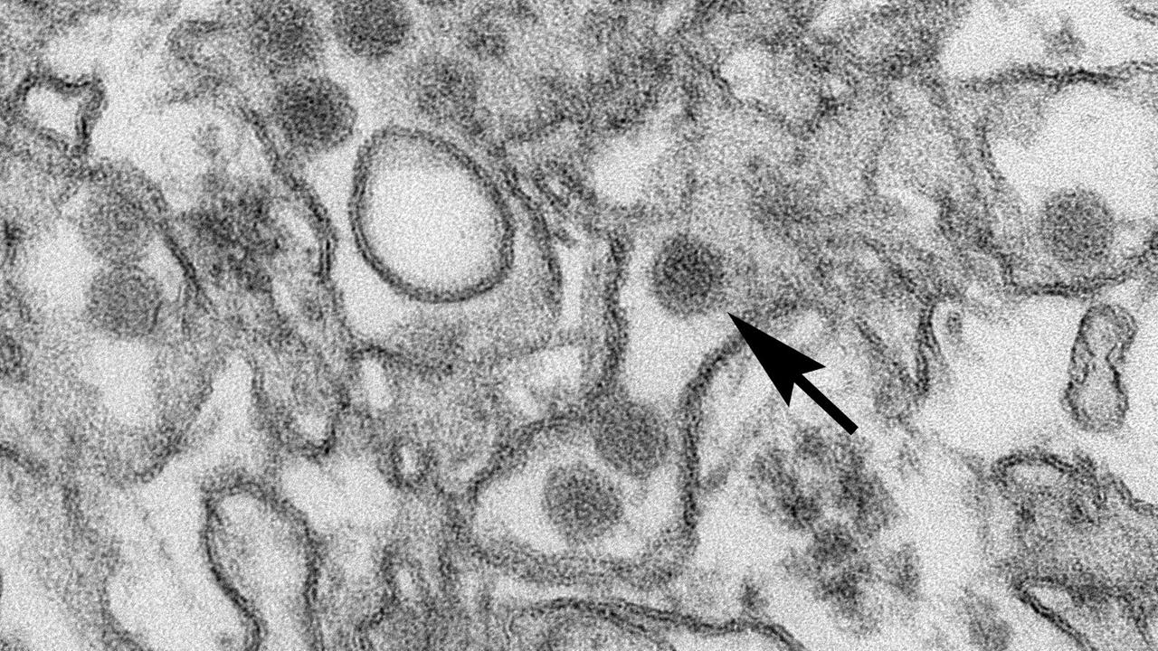 Zika-Virus unter dem Elektronenmikroskop. Es gehört zur Familie der Vlaviviridae. Die Virus-Partikel betragen 40 nm in Diameter mit einer äußeren Hülle und dem inneren Kern. Der Pfeil zeigt einen einzelnen Virus-Partikel. Das Zika-Virus wird durch Mückenstiche übertragen. Die bekanntesten Symptome sind Fieber, Ausschlag, Gelenkschmerzen und Bindehautentzündung (gerötete Augen). Das Virus steht im Verdacht, für Missbildungen bei Kindern verantwortlich zu sein.Foto: Cynthia Goldsmith / Center for  Disease Control and Prevention/dpa