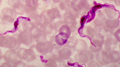 Trypanosoma brucei, der Erreger der afrikanischen Schlafkrankheit (stark rosa eingefärbt).  