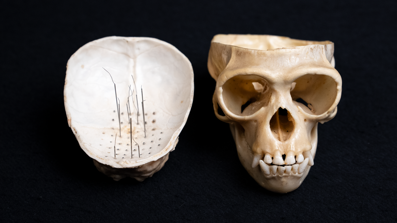Ein aufgeschnittener Affenschädel. Auf der Unterseite des Schädeldeckels sieht man wie feine Drähte (Elektroden) im Knochen verankert sind. 