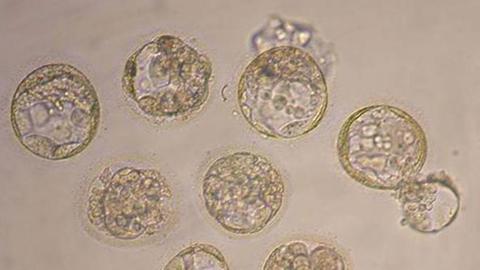 In Stammzellen sehen viele Forscher  eine Wunderwaffe zur Herstellung von Knorpelgewebe. 
