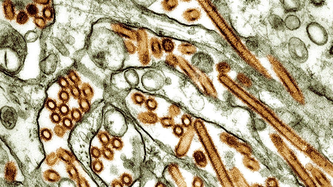 Das Vogelgrippe-Virus H5N1 unter dem Mikroskop
