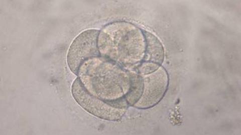 Mikroskopische Aufnahme einer Eizelle im Acht-Zellen-Stadium: Klon eines menschlichen Embryos