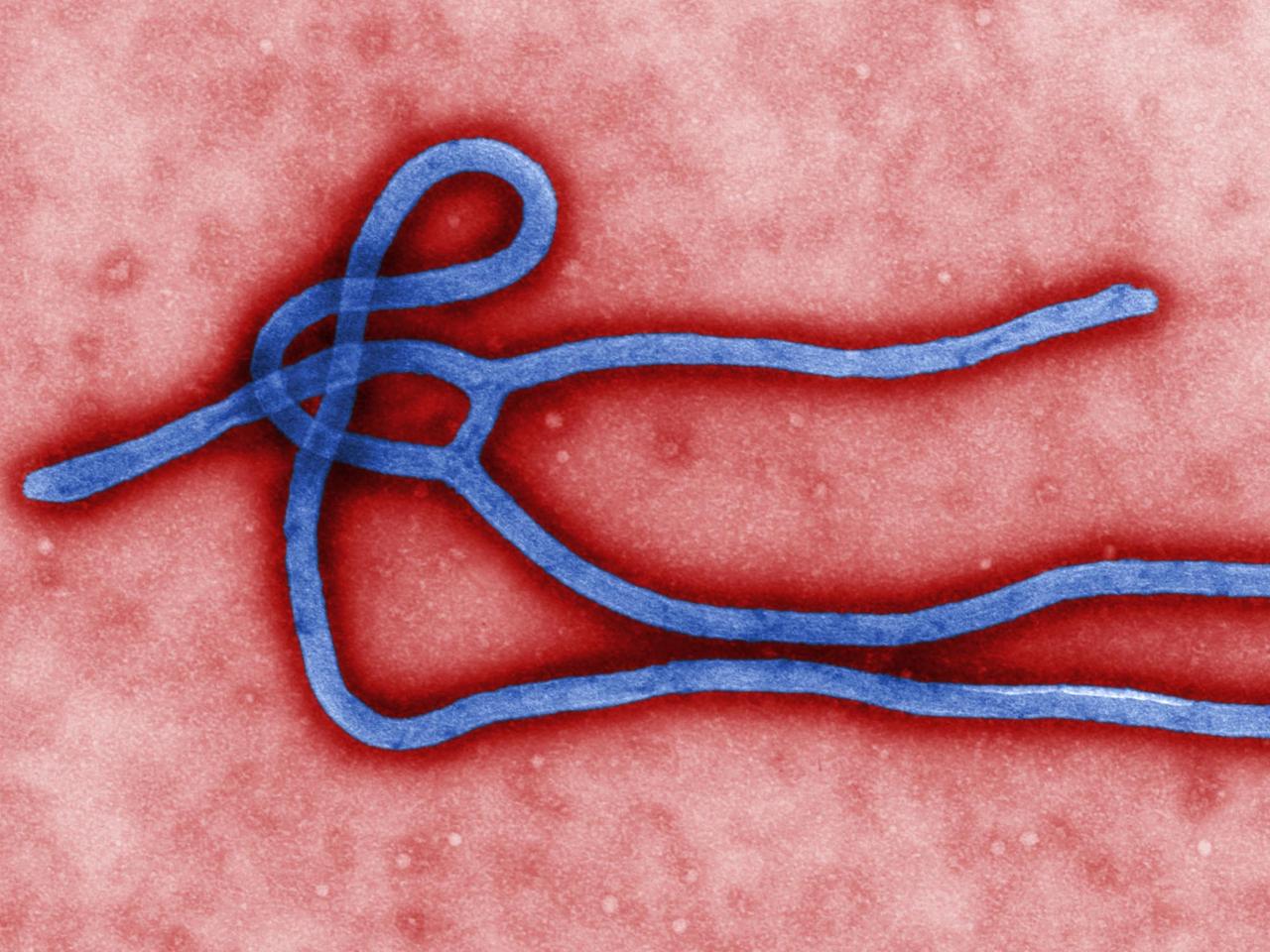 Farbige Elektronen-mikroskopische Darstellung der ultrastrukturellen Morphologie eines Ebola Virus Virion.
