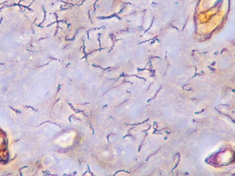 Syphilis-Erreger unter dem Mikroskop