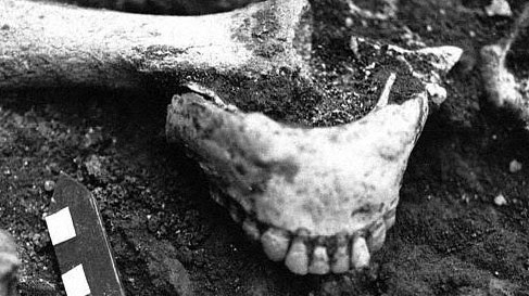 Unterkiefers eines Steinzeitmenschen, der im Sommer 1991 in Dmanisi, Südgeorgien, gefunden wurde. Die Entdeckung der etwa 1,8 Millionen Jahre alten Knochen galt als Sensation.
