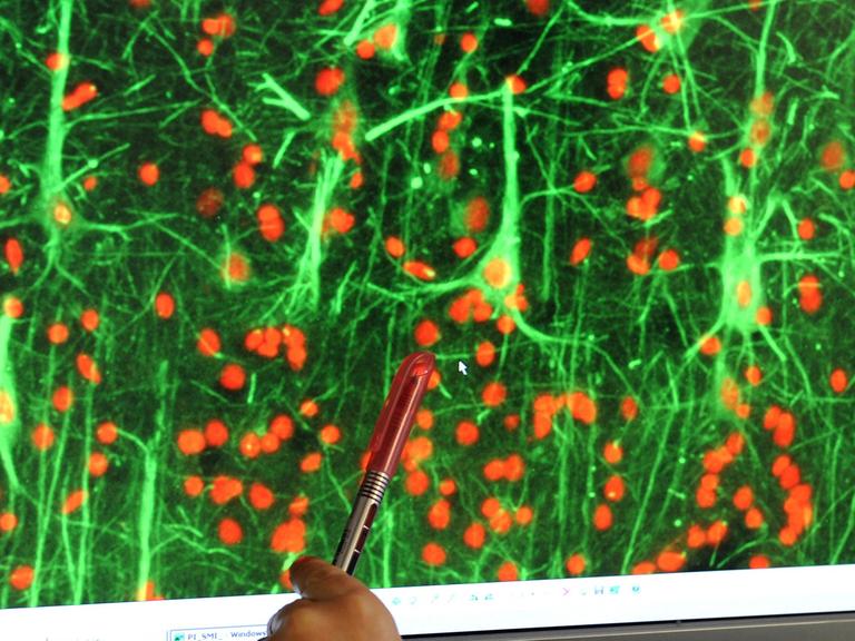 In einem Labor im Paul-Flechsig-Institut für Hirnforschung der Universität Leipzig kontrolliert Biologie-Doktorantin Anne Suttkus auf einem Bildschirm