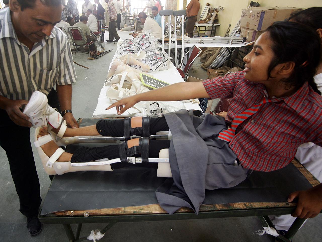 Ein Mädchen mit geschienten Beinen liegt auf einer Liege. Eine NGO kümmert sich um Polio-Patienten in Indien.