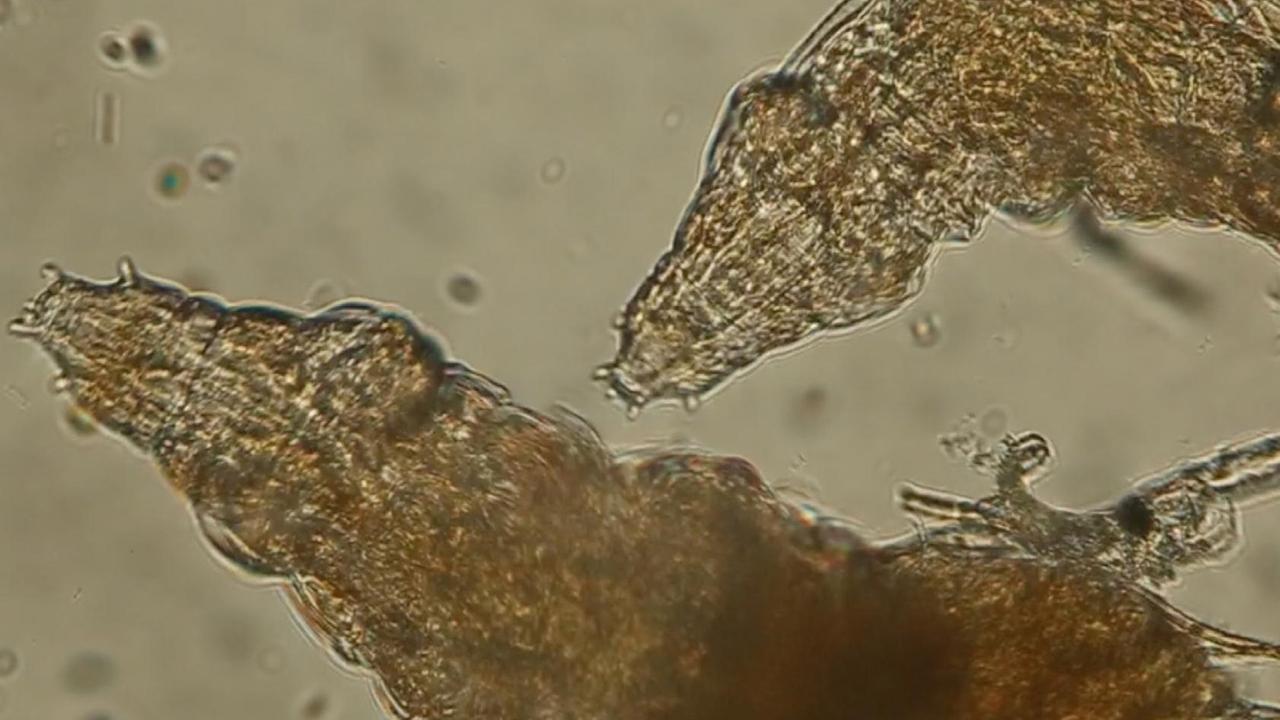 Eine Mikroskopaufnahme eines winzigen Bärtierchens, auch Tardigrada genannt