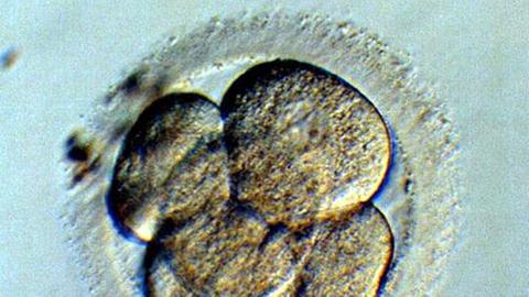 Bei der PID lässt man 'unbrauchbare' Embryonen in der Petrischale absterben. 