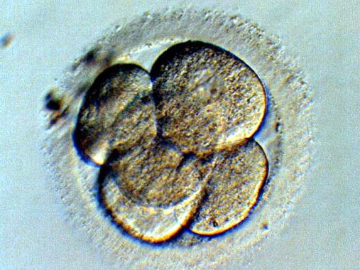 Menschlicher Embryo