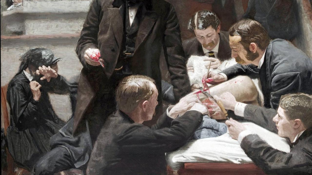Eine Operation in einem Hörsaal mit Zuschauern auf dem Gemälde "The Gross Clinic" von Thomas Eaktins aus dem 19. Jahrhundert.