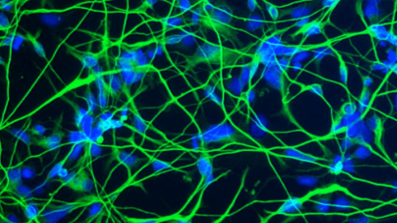 Nervenzellen mit der typischen Ausbildung von langen Nervenfortsätzen. Immunofluoreszenzfärbung gegen das neuronale Protein beta-III Tubulin (grün). Die Zellkerne sind in blau angefärbt.