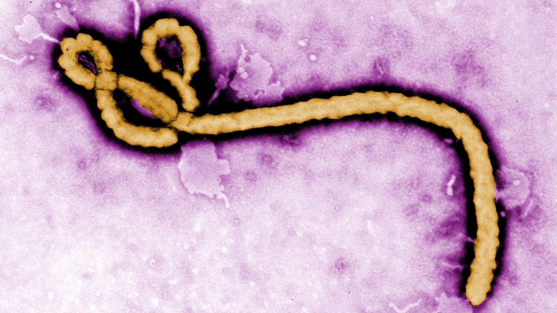 Mikroskop-Aufnahme des Ebola-Virus
