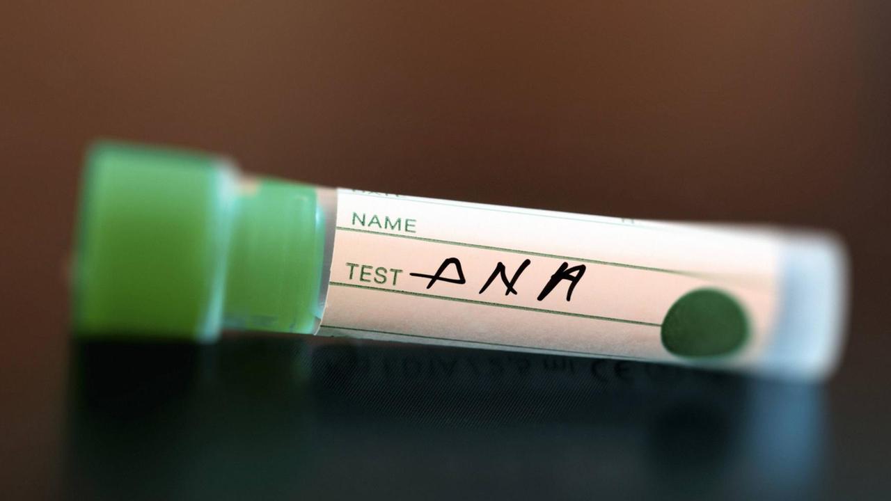 Röhrchen, auf dem "Test DNA" geschrieben steht