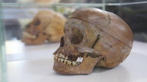Schädel eines Opfers des Völkermords in Namibia