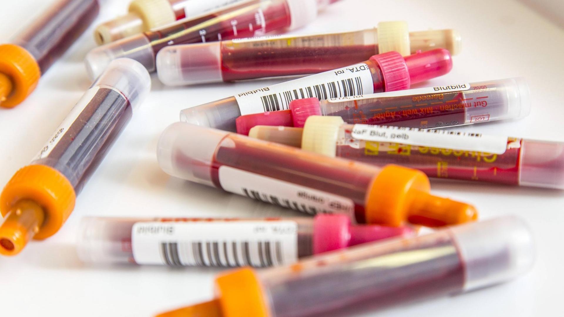 Blutproben in Blutentnahmeröhrchen. Probenbehältnis zur Entnahme und Aufbereitung von Blutproben, Barcode zur Identifizierung der Patienten.