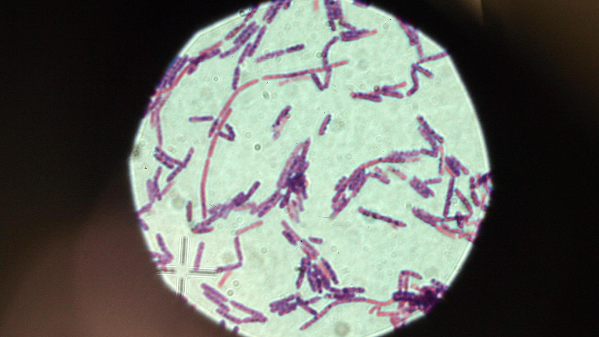 Milzbrand-Erreger unter dem Mikroskop