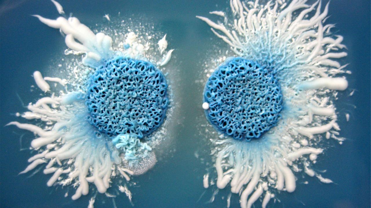 Schön, aber gefährlich: Zwei Kolonien des humanpathogenen Hefepilzes Candida albicans auf GM-Bromocresol-Agar, einem Spezialnährboden, der zu einer typischen Färbung der Zellen führt.