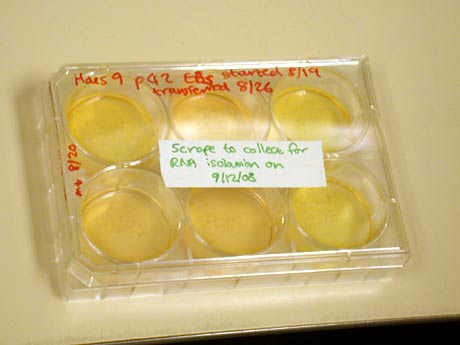 Unscheinbar und umstritten: Embryonale Stammzellen in Nährmedium