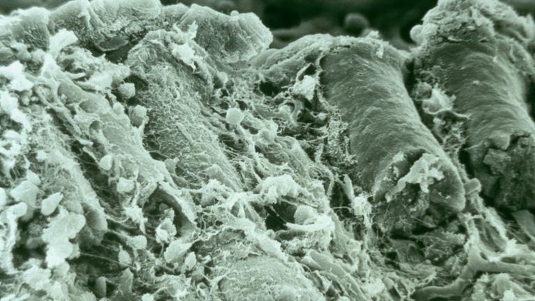 Medizin - Der Darm als \