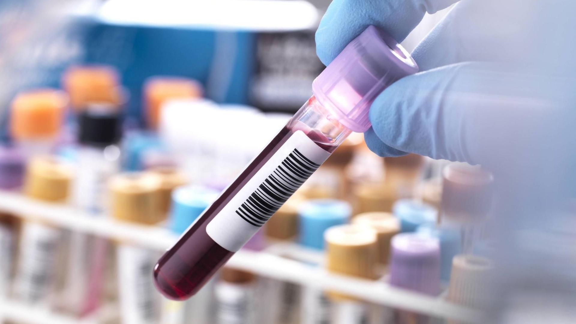 In einem Labor wird eine Blutprobe in einem Röhrchen hochgehalten.
